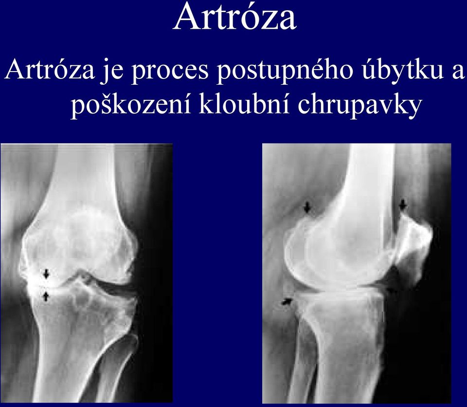 úbytku a poškození