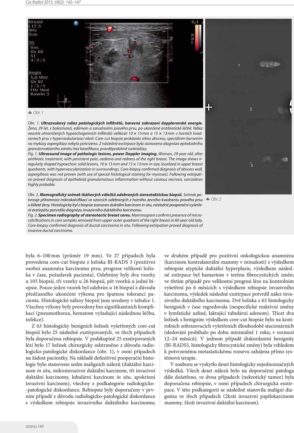 Core-cut biopsie prokázala stěnu abscesu, speciálním barvením na mykózy aspergilóza nebyla potvrzena.