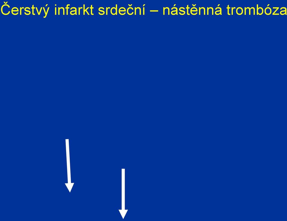 srdeční