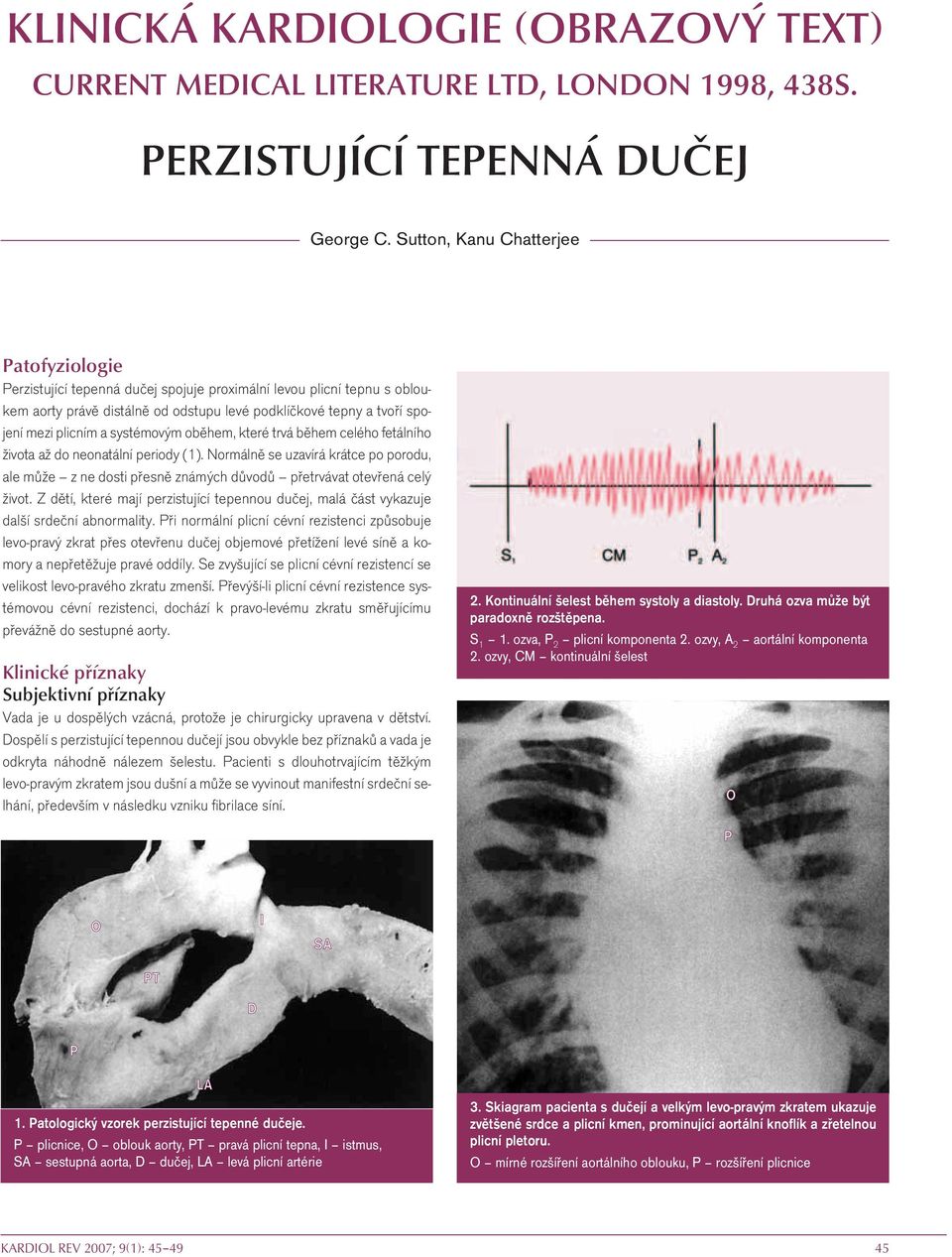 systémovým oběhem, které trvá během celého fetálního života až do neonatální periody (1).
