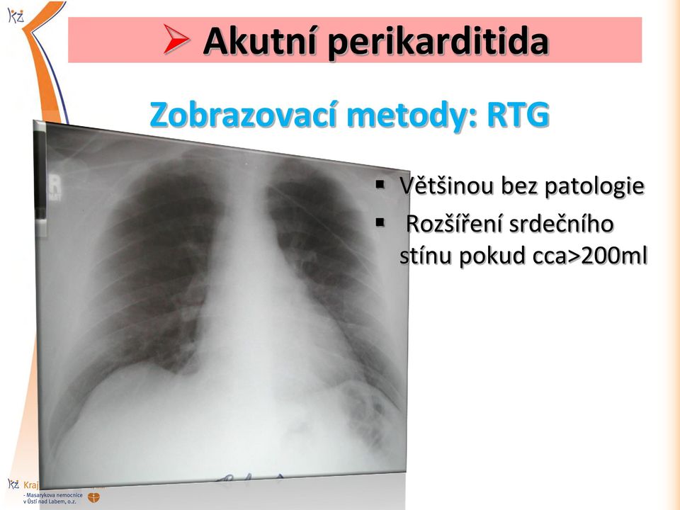 Většinou bez patologie