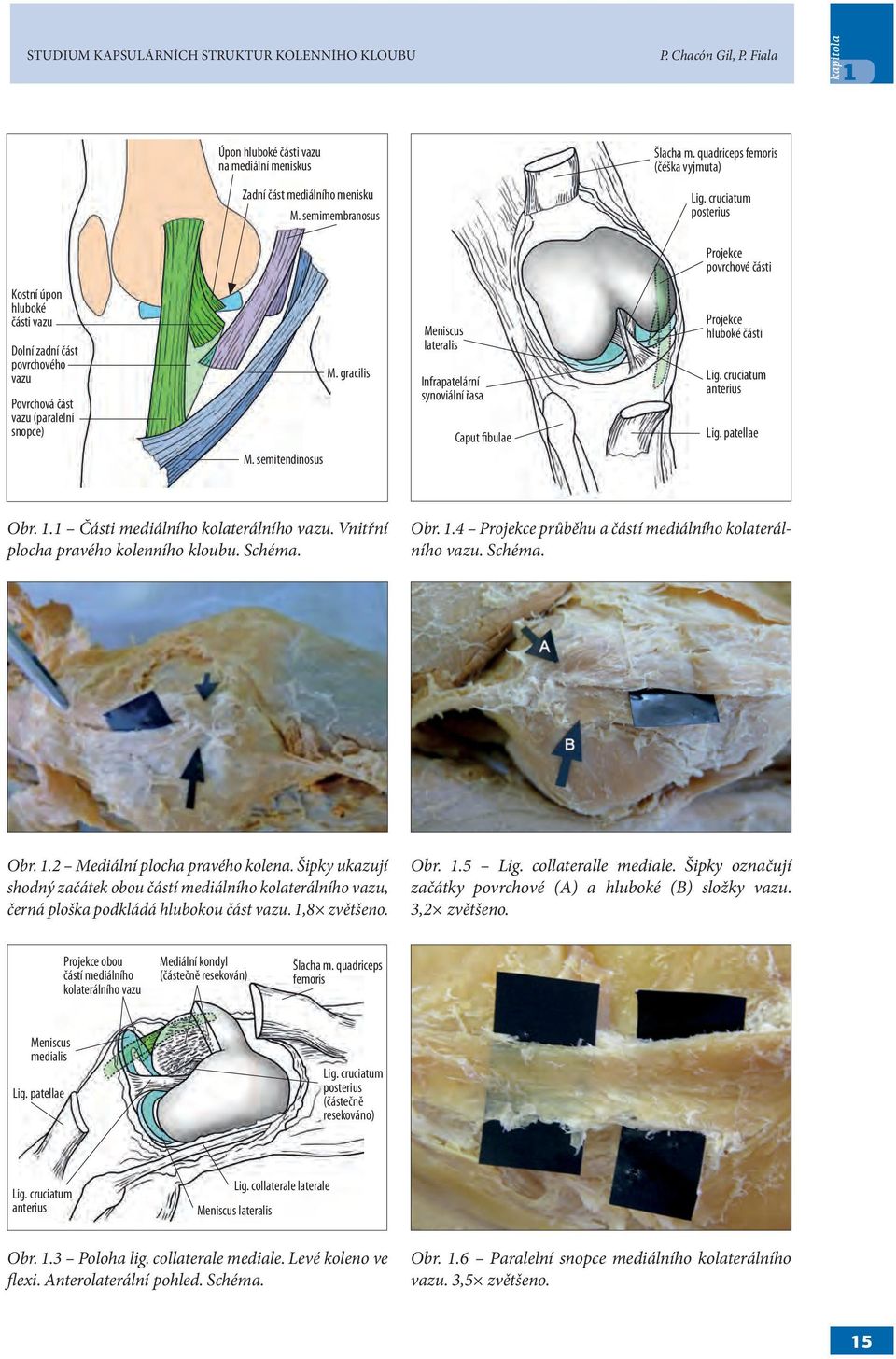 gracilis Meniscus lateralis Infrapatelární synoviální řasa Caput fibulae Projekce hluboké části Lig. cruciatum anterius Lig. patellae M. semitendinosus Obr. 1.1 Části mediálního kolaterálního vazu.