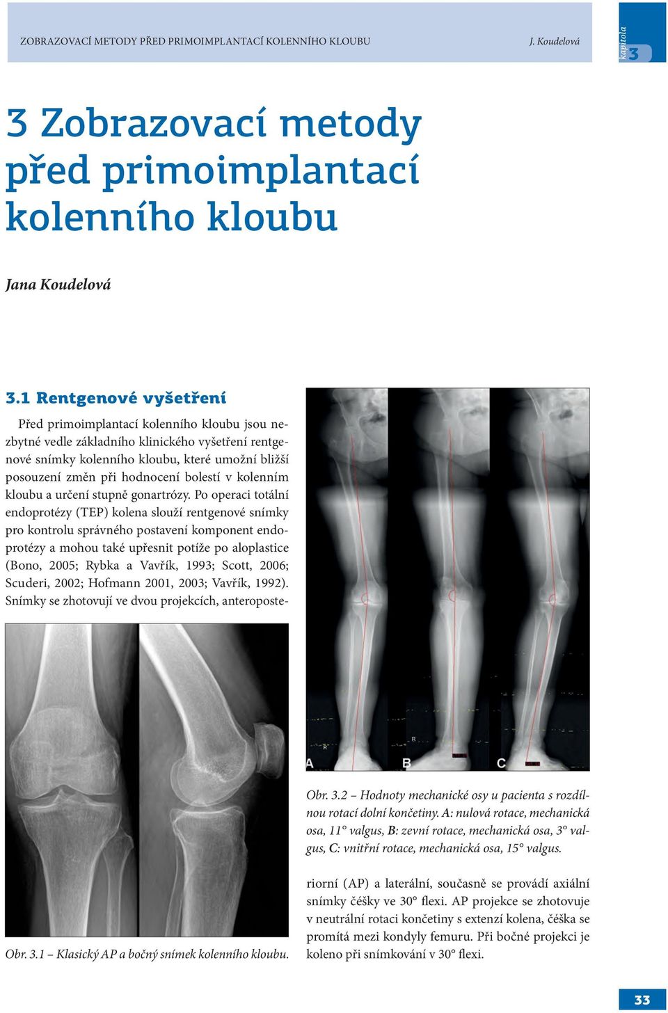 Před primoimplantací kolenního kloubu jsou nezbytné vedle základního klinického vyšetření rentgenové snímky kolenního kloubu, které umožní bližší posouzení změn při hodnocení bolestí v kolenním