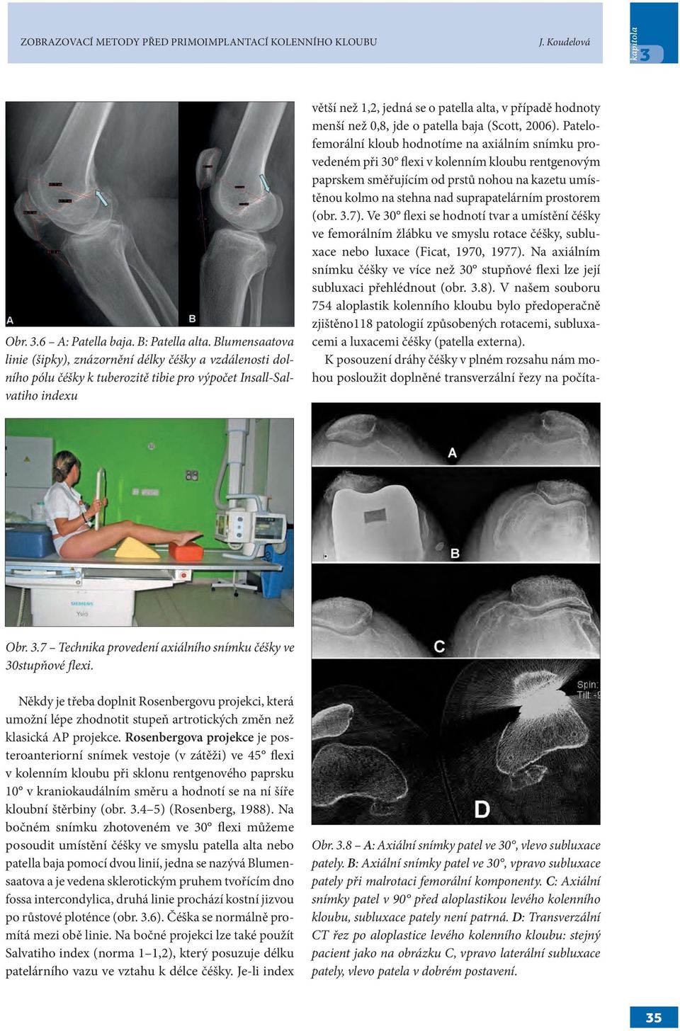 menší než 0,8, jde o patella baja (Scott, 2006).