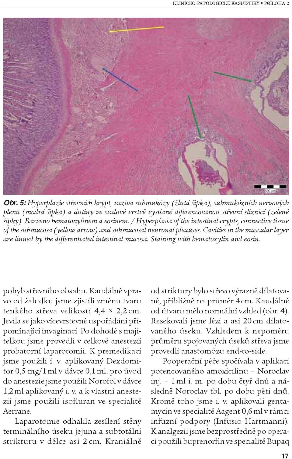 Cavities in the muscular layer are linned by the differentiated intestinal mucosa. Staining with hematoxylin and eosin. pohyb støevního obsahu.