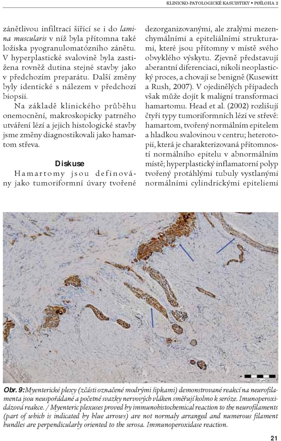 Na základì klinického prùbìhu onemocnìní, makroskopicky patrného utváøení lézí a jejich histologické stavby jsme zmìny diagnostikovali jako hamartom støeva.