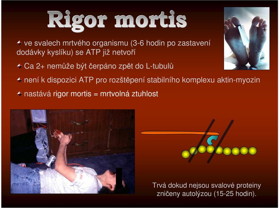 pro rozštěpení stabilního komplexu aktin-myozin nastává rigor mortis =