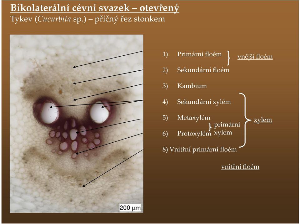 Sekundární floém 3) Kambium 4) Sekundární xylém 5) Metaxylém