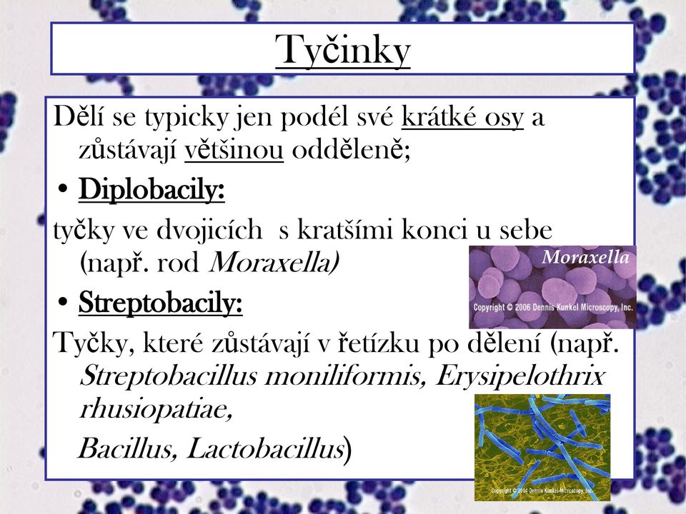 rod Moraxella) Streptobacily: Tyčky, které zůstávají v řetízku po dělení (např.