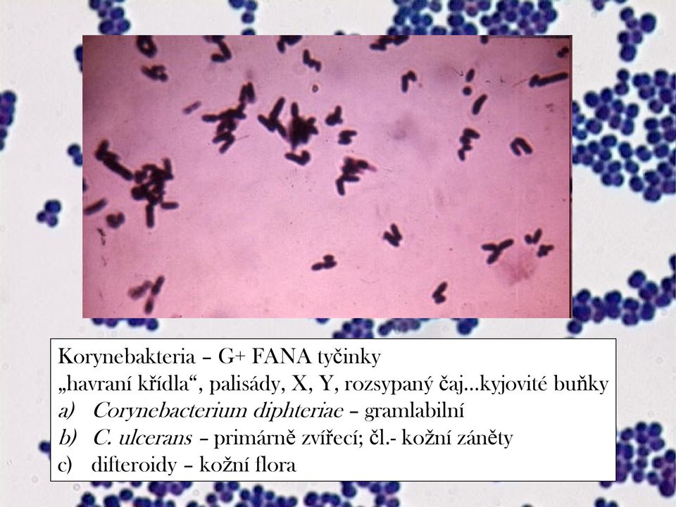 Corynebacterium diphteriae gramlabilní b) C.
