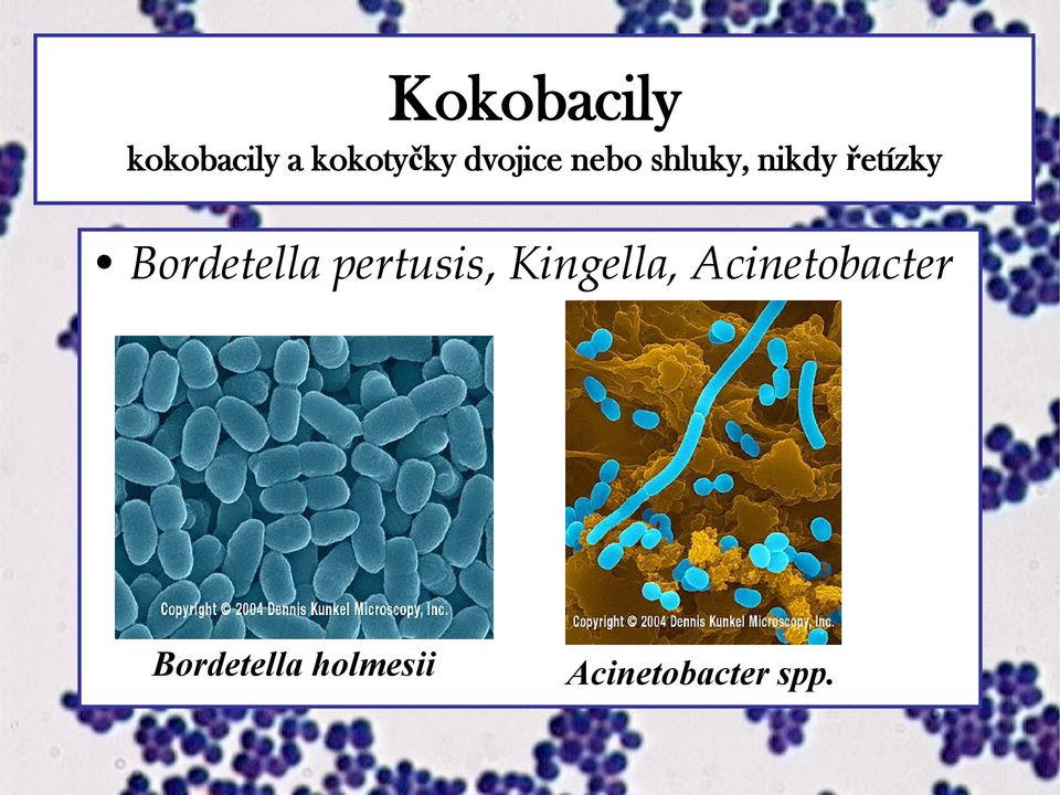Bordetella pertusis, Kingella,
