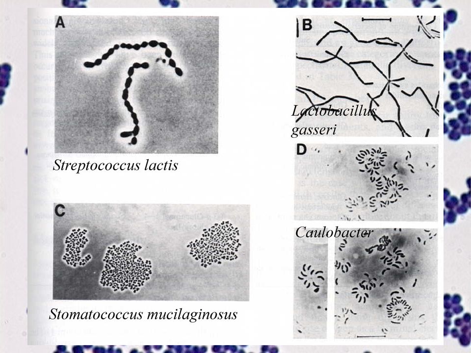 Streptococcus lactis
