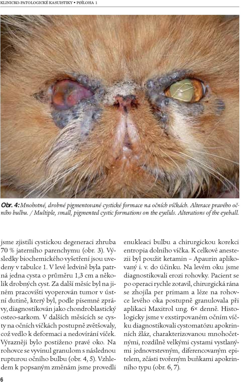 V levé ledvinì byla patrná jedna cysta o prùmìru 1,3 cm a nìkolik drobných cyst.