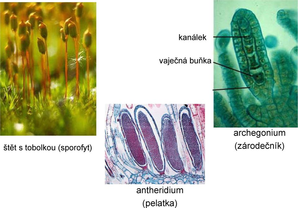 (sporofyt) archegonium