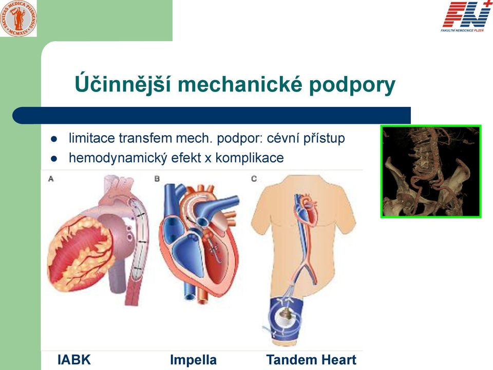 podpor: cévní přístup