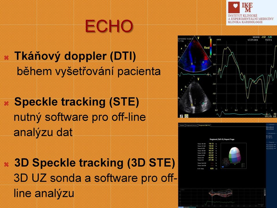 pro off-line analýzu dat 3D Speckle tracking