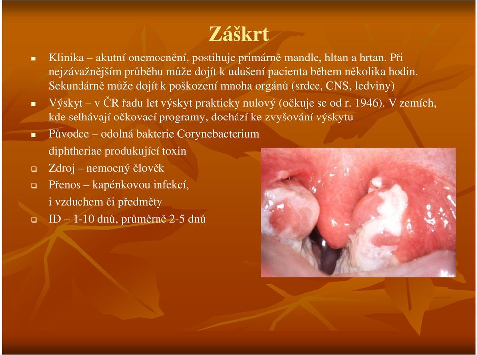 Sekundárně může dojít k poškození mnoha orgánů (srdce, CNS, ledviny) Výskyt v ČR řadu let výskyt prakticky nulový (očkuje se od r.