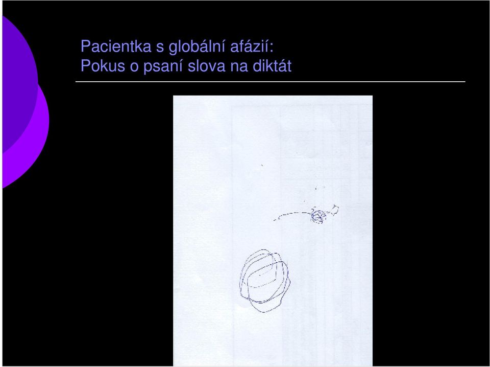 afázií: Pokus