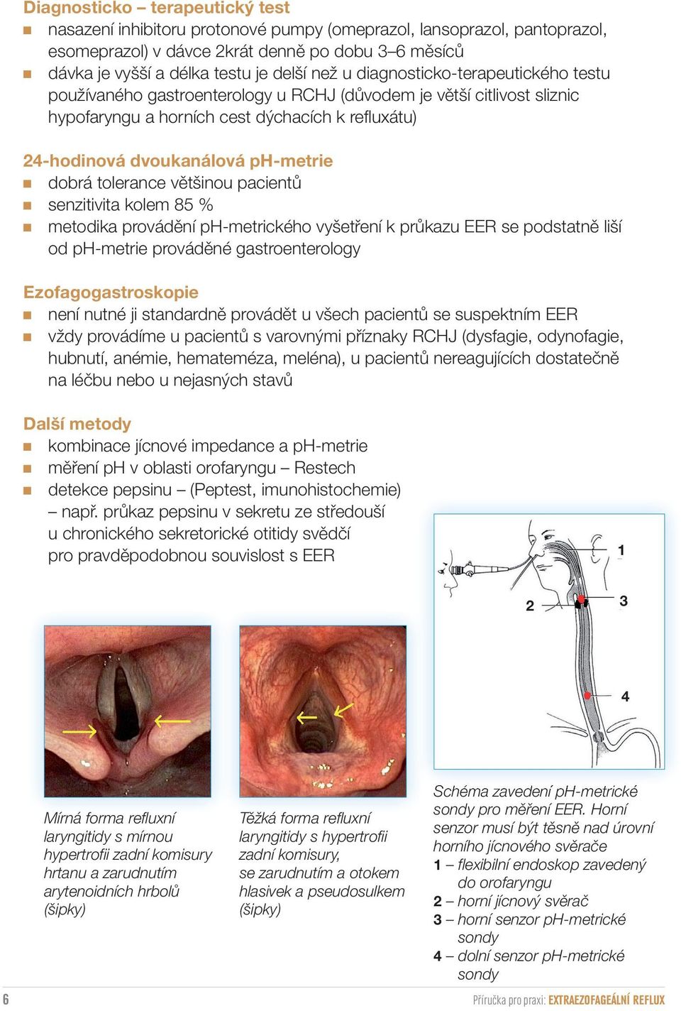 tolerance většinou pacientů senzitivita kolem 85 % metodika provádění ph-metrického vyšetření k průkazu EER se podstatně liší od ph-metrie prováděné gastroenterology Ezofagogastroskopie není nutné ji