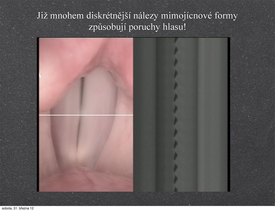 nálezy mimojícnové