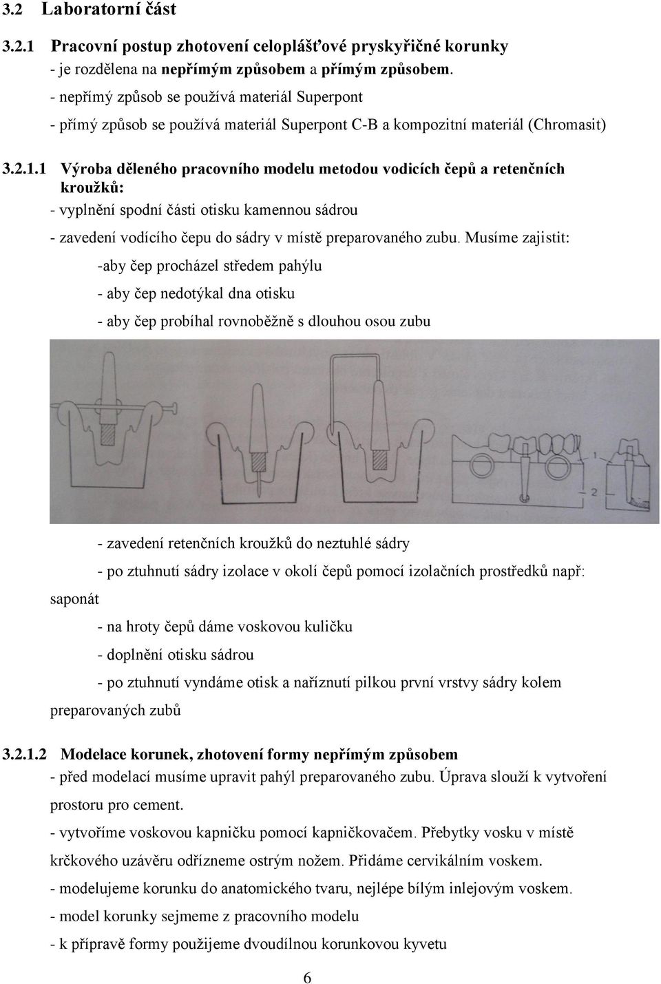 1 Výroba děleného pracovního modelu metodou vodicích čepů a retenčních kroužků: - vyplnění spodní části otisku kamennou sádrou - zavedení vodícího čepu do sádry v místě preparovaného zubu.