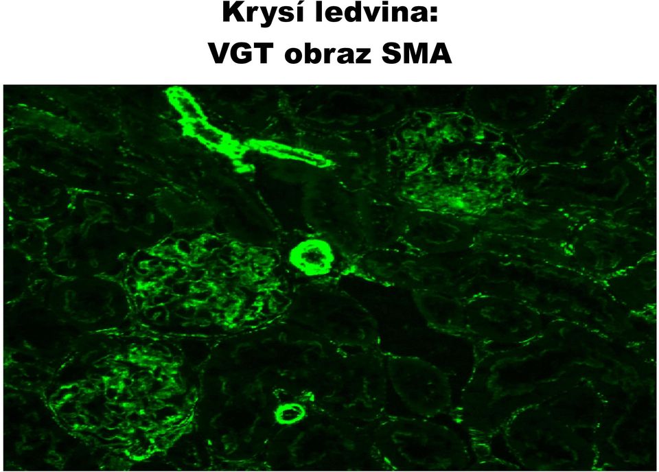 VGT obraz