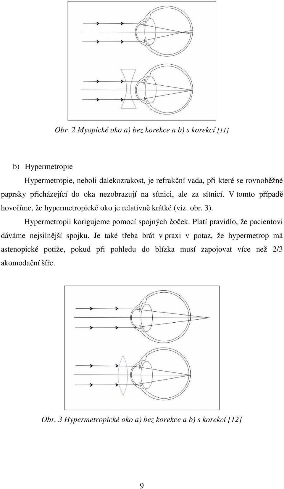 Hypermetropii korigujeme pomocí spojných čoček. Platí pravidlo, že pacientovi dáváme nejsilnější spojku.