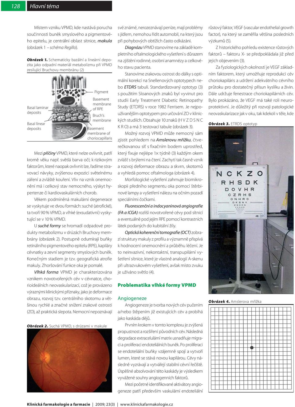 s membrane Basement membrane of choriocapillaris Mezi příčiny VPMD, které nelze ovlivnit, patří kromě věku např.