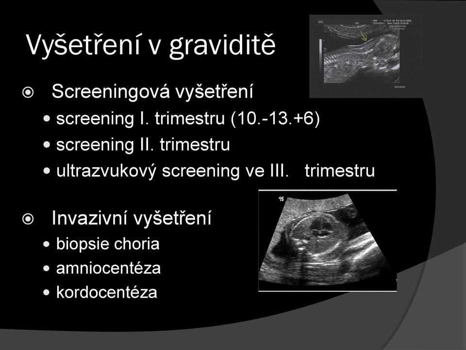 trimestru ultrazvukový screening ve III.