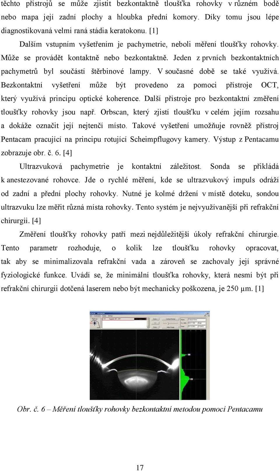 V současné době se také využívá. Bezkontaktní vyšetření může být provedeno za pomoci přístroje OCT, který využívá principu optické koherence.
