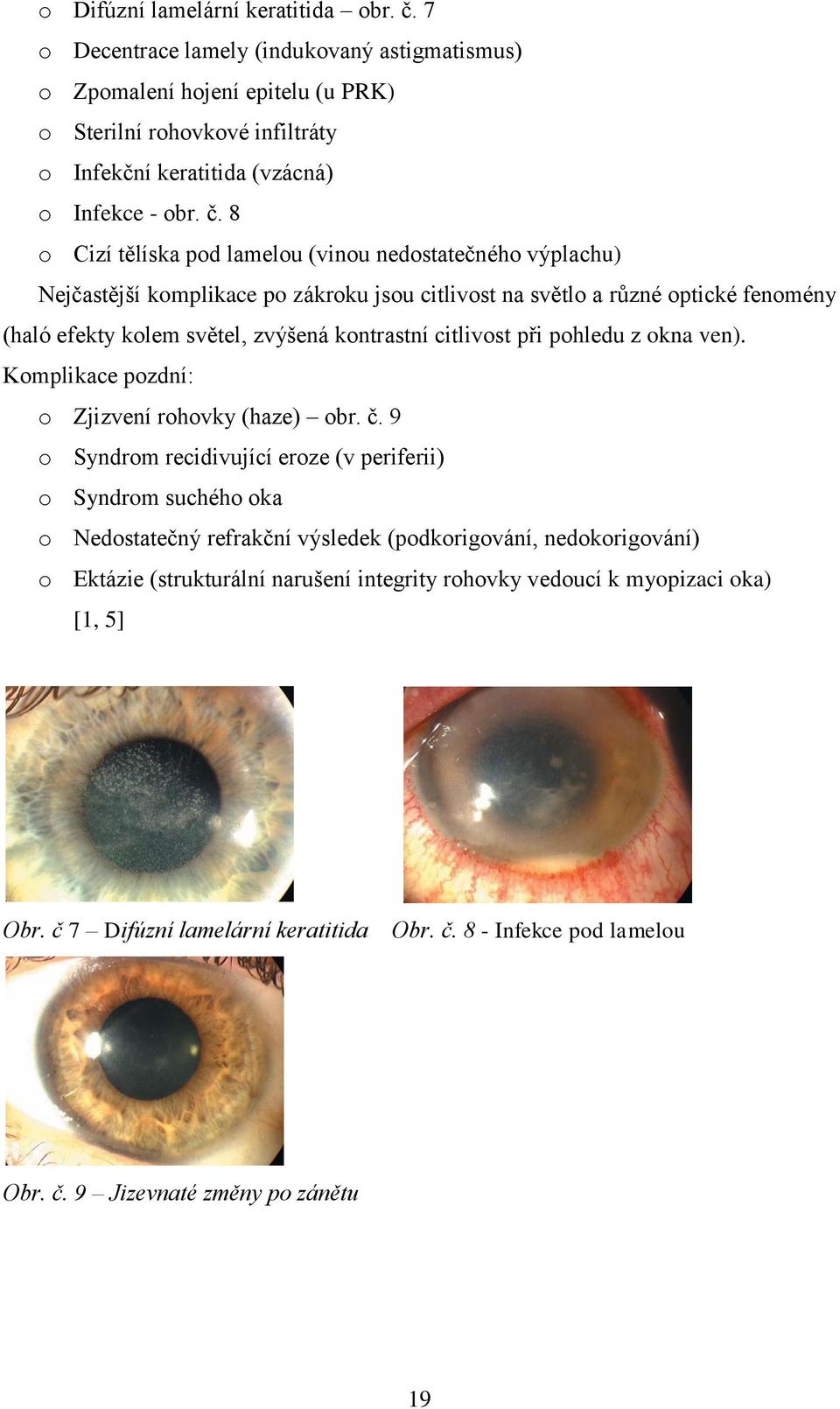 8 o Cizí tělíska pod lamelou (vinou nedostatečného výplachu) Nejčastější komplikace po zákroku jsou citlivost na světlo a různé optické fenomény (haló efekty kolem světel, zvýšená kontrastní