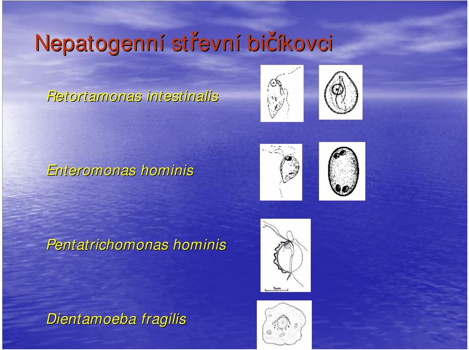 Enteromonas hominis