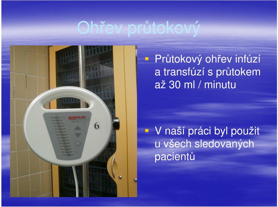 30 ml / minutu V naší práci byl