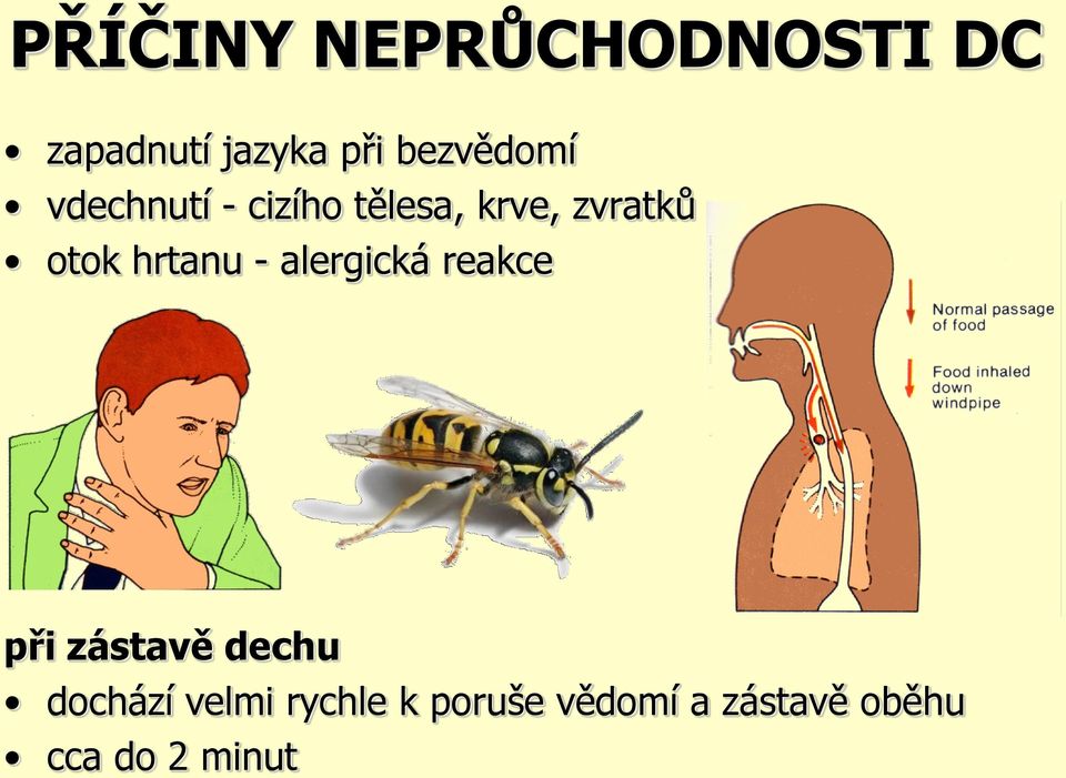 otok hrtanu - alergická reakce při zástavě dechu