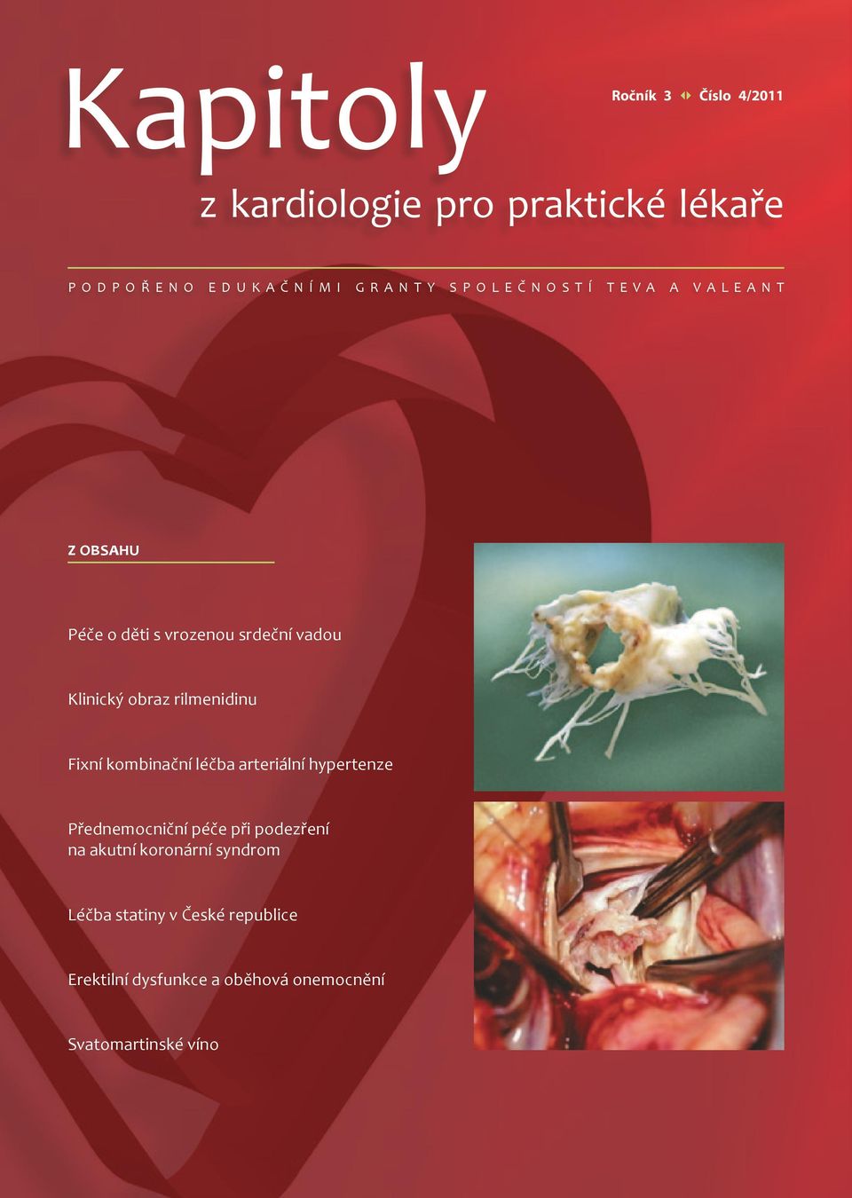 rilmenidinu Fixní kombinační léčba arteriální hypertenze Přednemocniční péče při podezření na