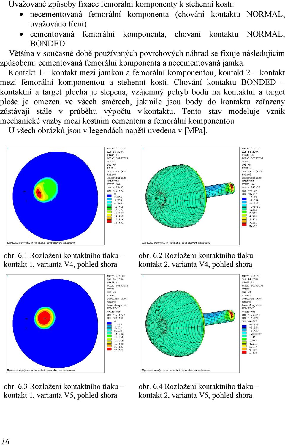 Kontakt 1 kontakt mezi jamkou a femorální komponentou, kontakt 2 kontakt mezi femorální komponentou a stehenní kosti.