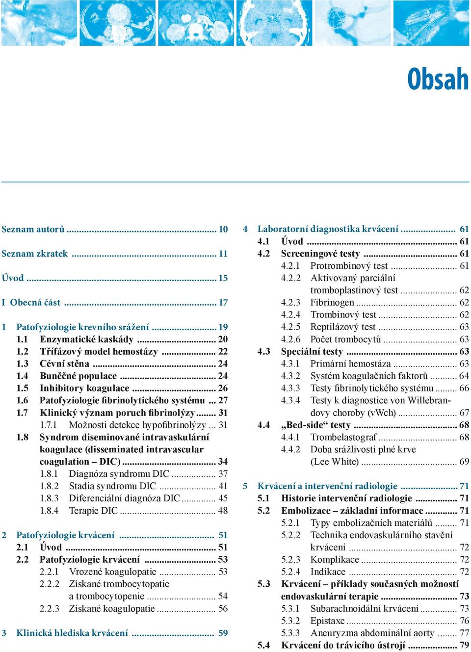 .. 31 1.8 Syndrom diseminované intravaskulární koagulace (disseminated intravascular coagulation DIC)... 34 1.8.1 Diagnóza syndromu DIC... 37 1.8.2 Stadia syndromu DIC... 41 1.8.3 Diferenciální diagnóza DIC.