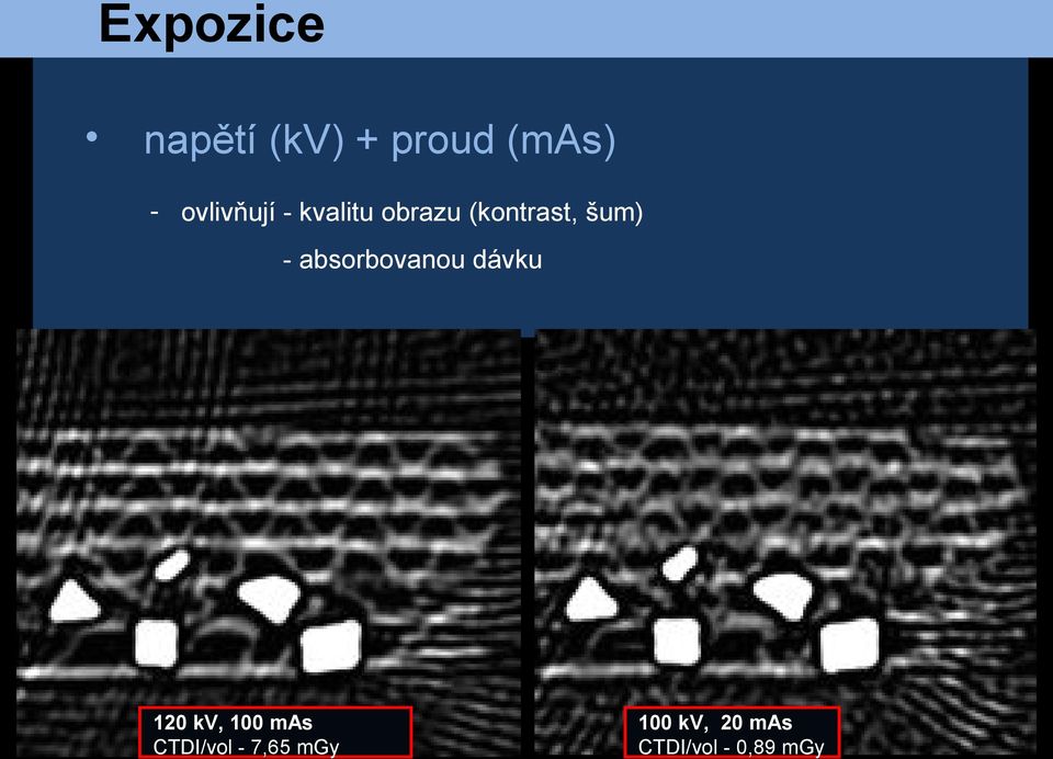 - absorbovanou dávku 120 kv, 100 mas