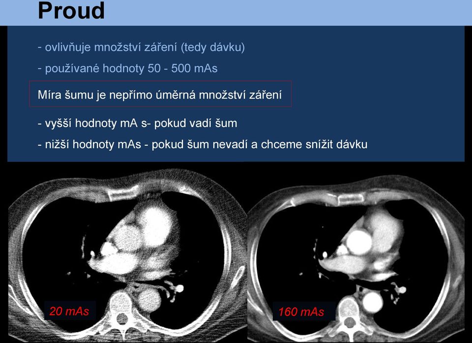 záření - vyšší hodnoty ma s- pokud vadí šum - nižší