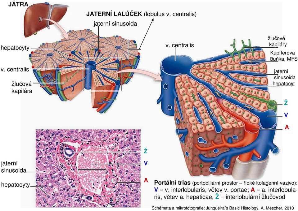 Portální trias (portobiliární prostor řídké kolagenní vazivo): V = v. interlobularis, větev v. portae; A = a.