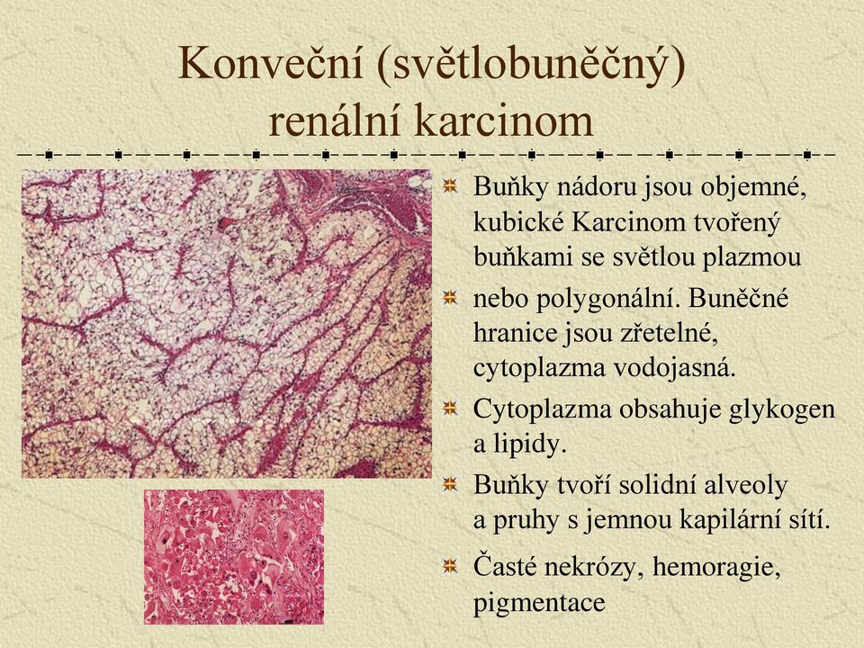 Buněčné hranice jsou zřetelné, cytoplazma vodojasná.