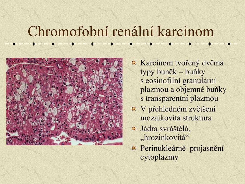 transparentní plazmou V přehledném zvětšení mozaikovitá