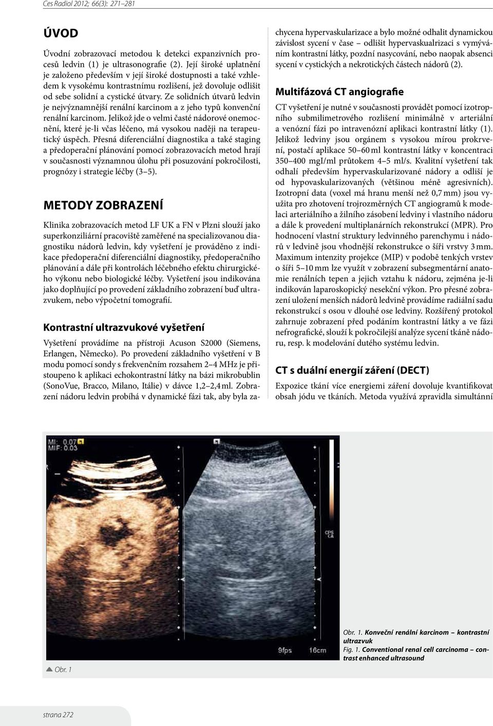 Ze solidních útvarů ledvin je nejvýznamnější renální karcinom a z jeho typů konvenční renální karcinom.