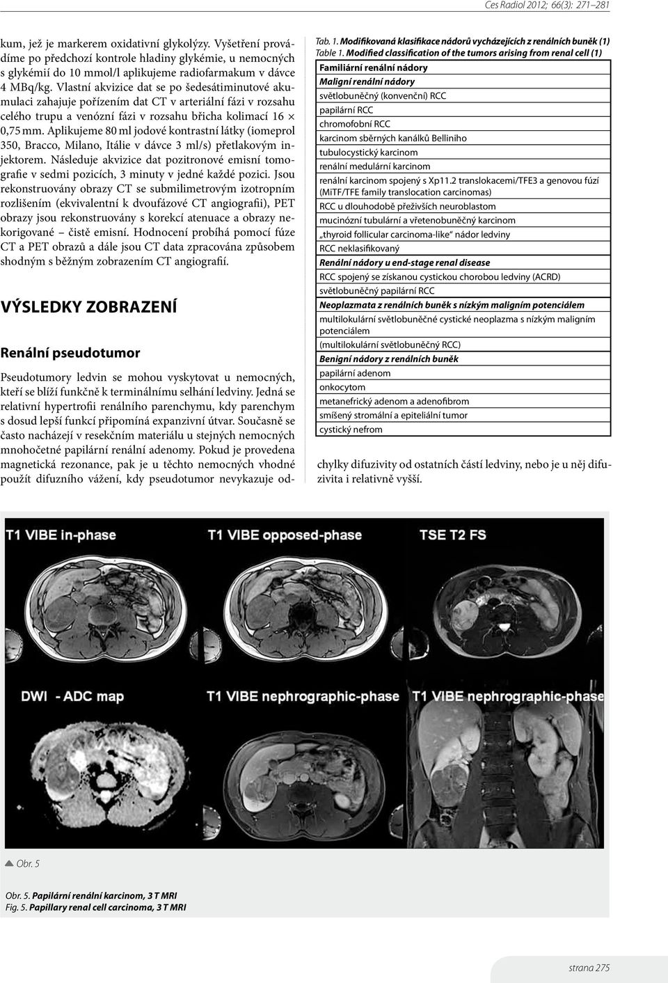 Aplikujeme 80 ml jodové kontrastní látky (iomeprol 350, Bracco, Milano, Itálie v dávce 3 ml/s) přetlakovým injektorem.