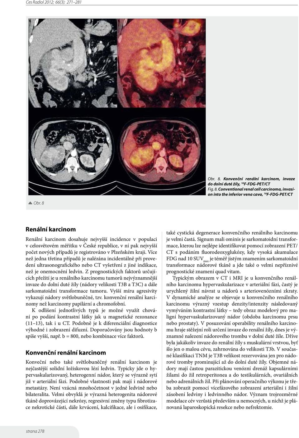 Více než jedna třetina případů je nalézána incidentálně při provedení ultrasonografického nebo CT vyšetření z jiné indikace, než je onemocnění ledvin.