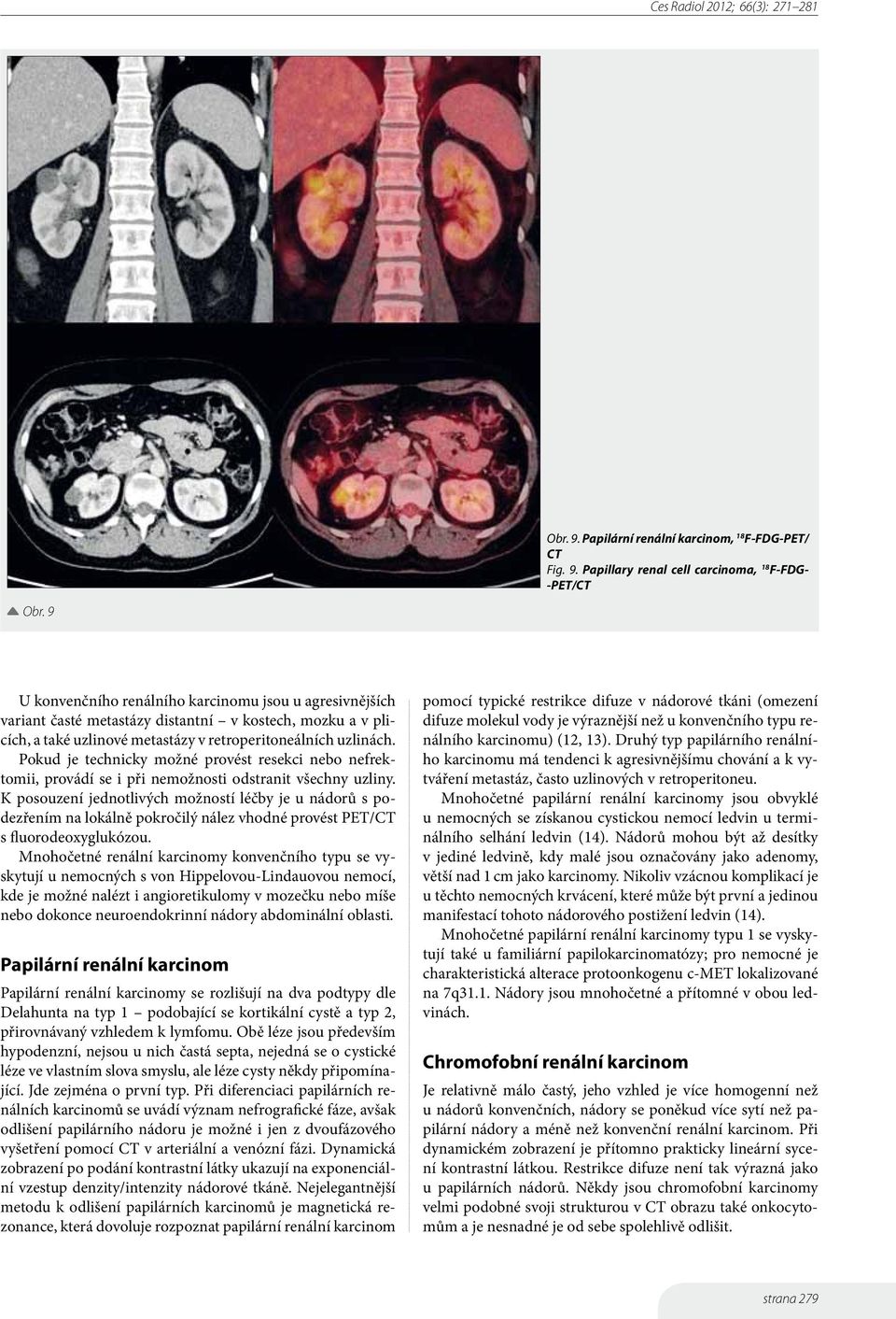 Pokud je technicky možné provést resekci nebo nefrektomii, provádí se i při nemožnosti odstranit všechny uzliny.
