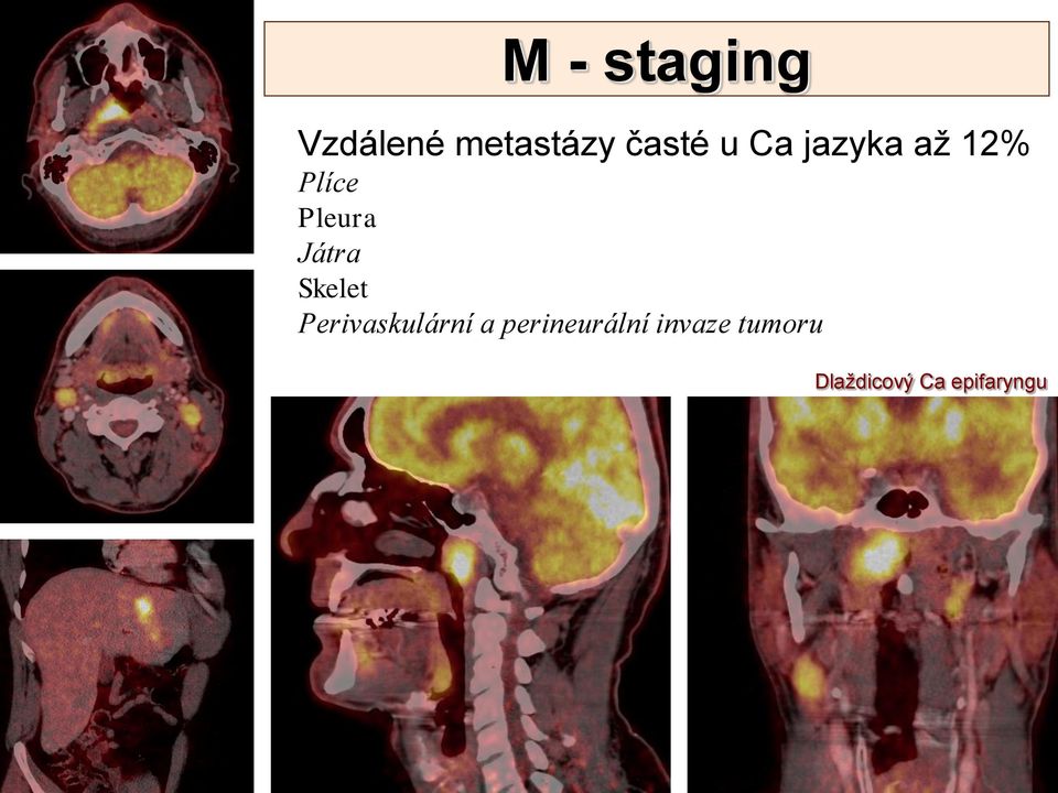 Skelet Perivaskulární a perineurální