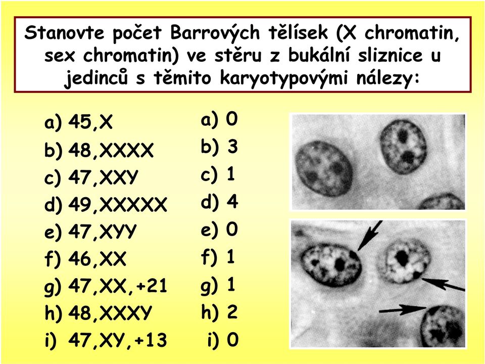 a) 45,X b) 48,XXXX c) 47,XXY d) 49,XXXXX e) 47,XYY f) 46,XX g)