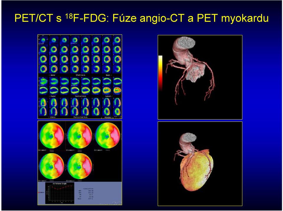 angio-ct a