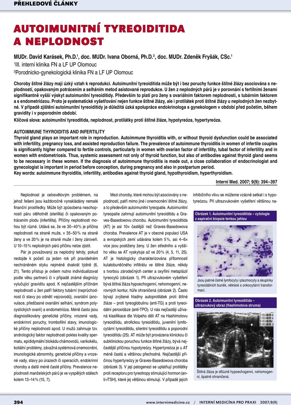 Autoimunitní tyreoiditida může být i bez poruchy funkce štítné žlázy asociována s neplodností, opakovaným potrácením a selháním metod asistované reprodukce.